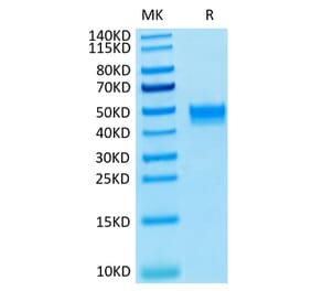 Tris-Bis PAGE - Recombinant Human FGFR3 Protein (C-terminal His and Avi Tag) (A330652) - Antibodies.com