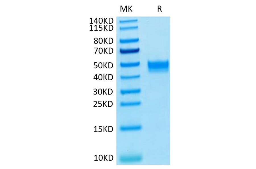 Tris-Bis PAGE - Recombinant Human FGFR3 Protein (C-terminal His and Avi Tag) (A330652) - Antibodies.com