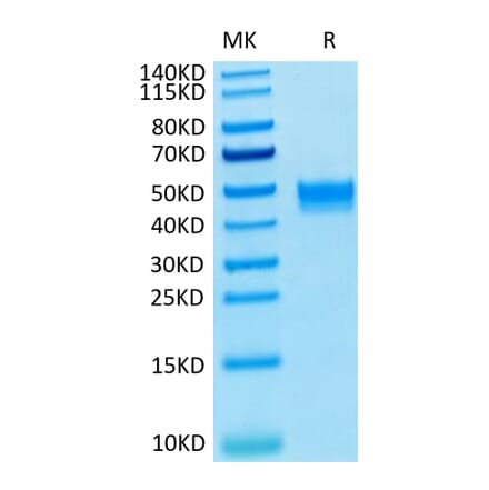 Tris-Bis PAGE - Recombinant Human FGFR3 Protein (C-terminal His and Avi Tag) (A330652) - Antibodies.com