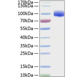 SDS-PAGE - Recombinant Human FGFR4 Protein (C-terminal Human Fc and His Tag) (A330653) - Antibodies.com