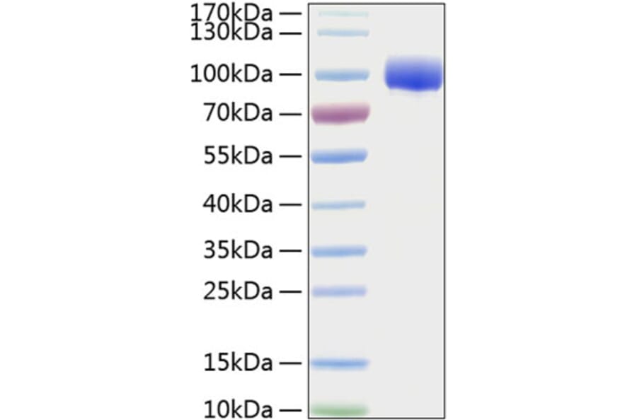 SDS-PAGE - Recombinant Human FGFR4 Protein (C-terminal Human Fc and His Tag) (A330653) - Antibodies.com