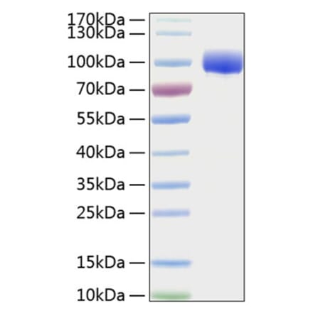 SDS-PAGE - Recombinant Human FGFR4 Protein (C-terminal Human Fc and His Tag) (A330653) - Antibodies.com