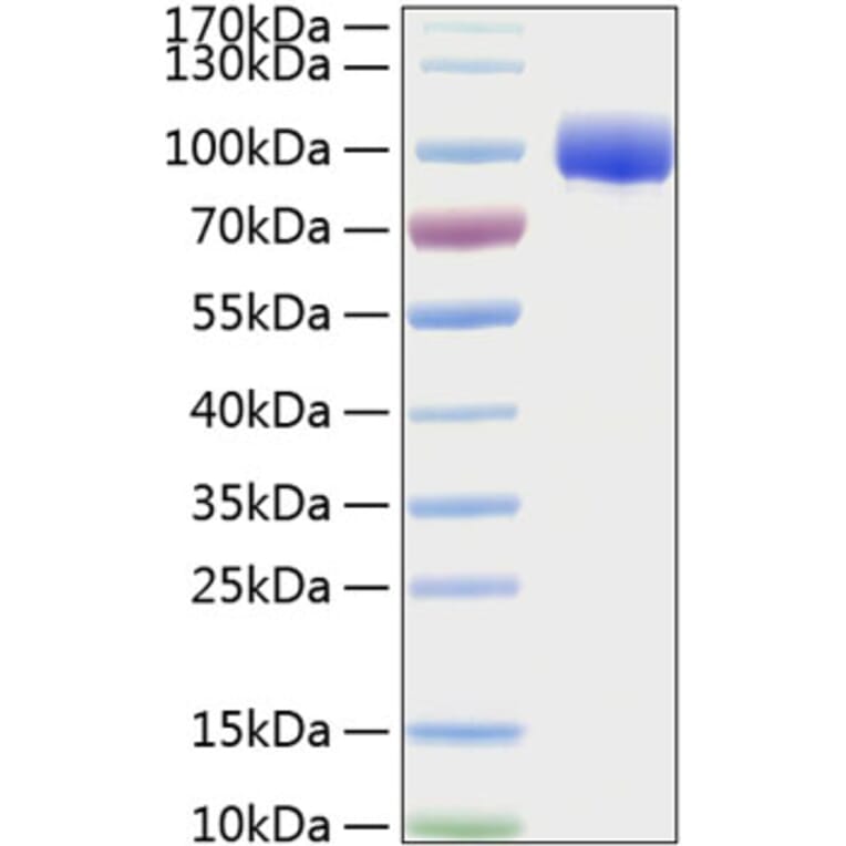 SDS-PAGE - Recombinant Human FGFR4 Protein (C-terminal Human Fc and His Tag) (A330653) - Antibodies.com