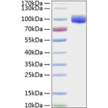 SDS-PAGE - Recombinant Human FGFR4 Protein (C-terminal Human Fc and His Tag) (A330653) - Antibodies.com