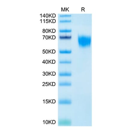Tris-Bis PAGE - Recombinant Human FGFR4 Protein (Biotin) (C-terminal His and Avi Tag) (A330654) - Antibodies.com