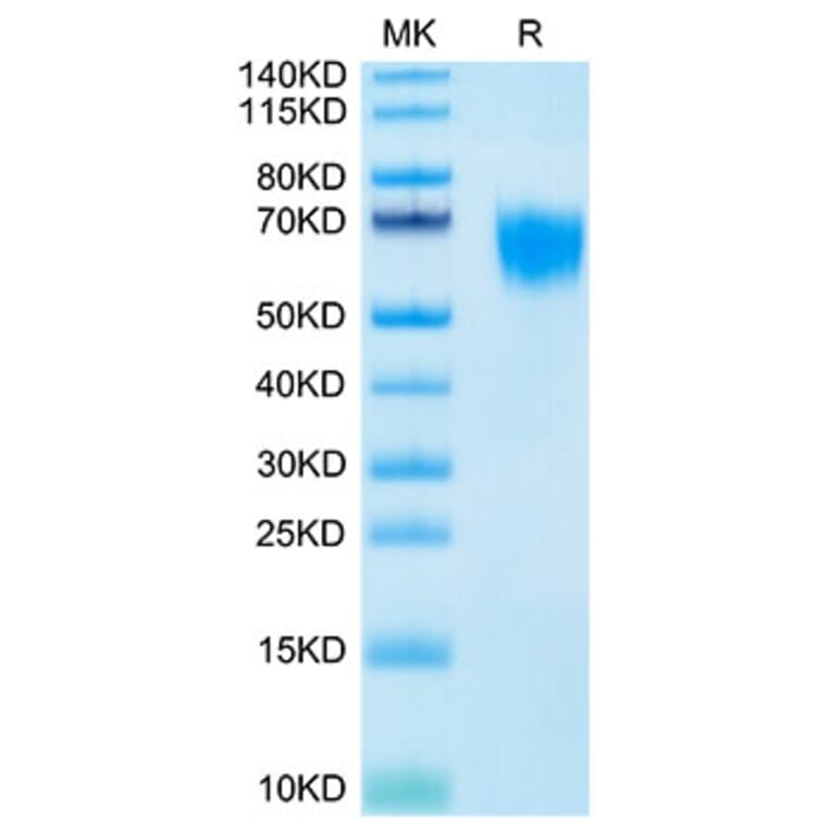 Tris-Bis PAGE - Recombinant Human FGFR4 Protein (Biotin) (C-terminal His and Avi Tag) (A330654) - Antibodies.com