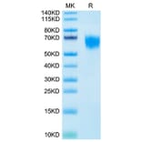 Tris-Bis PAGE - Recombinant Human FGFR4 Protein (Biotin) (C-terminal His and Avi Tag) (A330654) - Antibodies.com