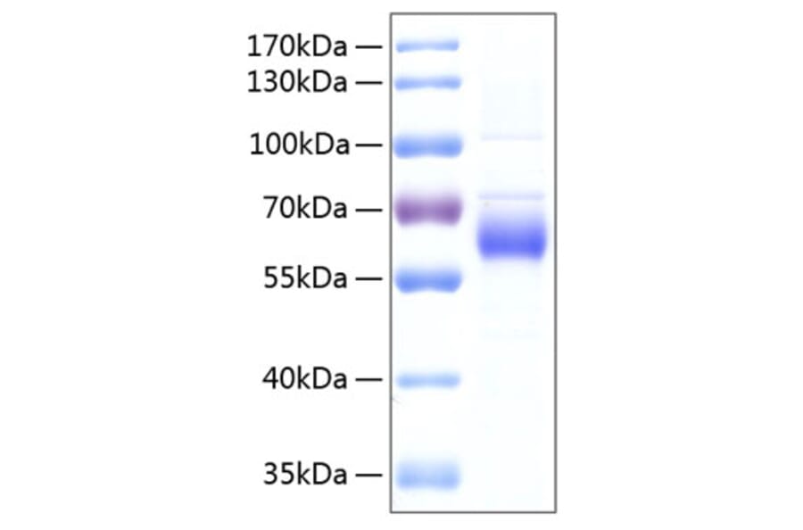 SDS-PAGE - Recombinant Human FGFRL1 Protein (C-terminal His Tag) (A330655) - Antibodies.com