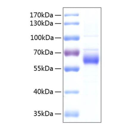 SDS-PAGE - Recombinant Human FGFRL1 Protein (C-terminal His Tag) (A330655) - Antibodies.com