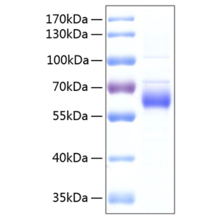 SDS-PAGE - Recombinant Human FGFRL1 Protein (C-terminal His Tag) (A330655) - Antibodies.com