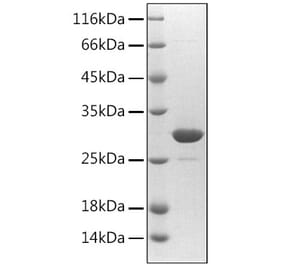 SDS-PAGE - Recombinant Human Fibrillin 1 Protein (N-terminal His Tag) (A330656) - Antibodies.com