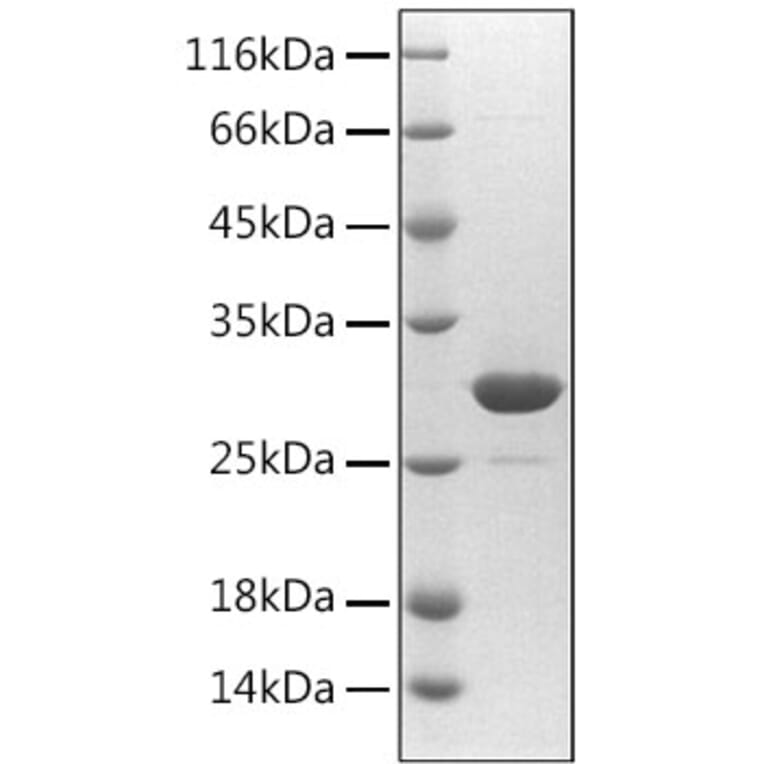 SDS-PAGE - Recombinant Human Fibrillin 1 Protein (N-terminal His Tag) (A330656) - Antibodies.com