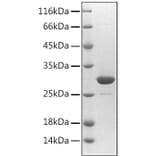SDS-PAGE - Recombinant Human Fibrillin 1 Protein (N-terminal His Tag) (A330656) - Antibodies.com