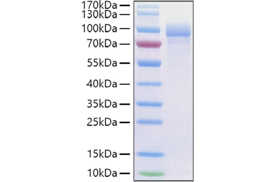 SDS-PAGE - Recombinant Human Fibronectin Protein (C-terminal His Tag) (A330657) - Antibodies.com