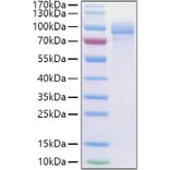 SDS-PAGE - Recombinant Human Fibronectin Protein (C-terminal His Tag) (A330657) - Antibodies.com