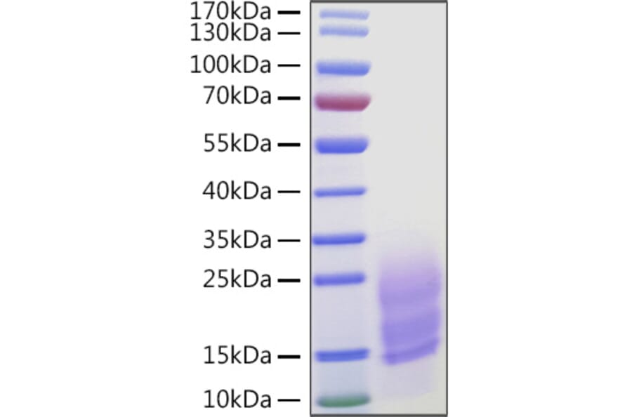 SDS-PAGE - Recombinant Human Fibronectin Protein (C-terminal His Tag) (A330658) - Antibodies.com