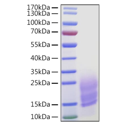 SDS-PAGE - Recombinant Human Fibronectin Protein (C-terminal His Tag) (A330658) - Antibodies.com