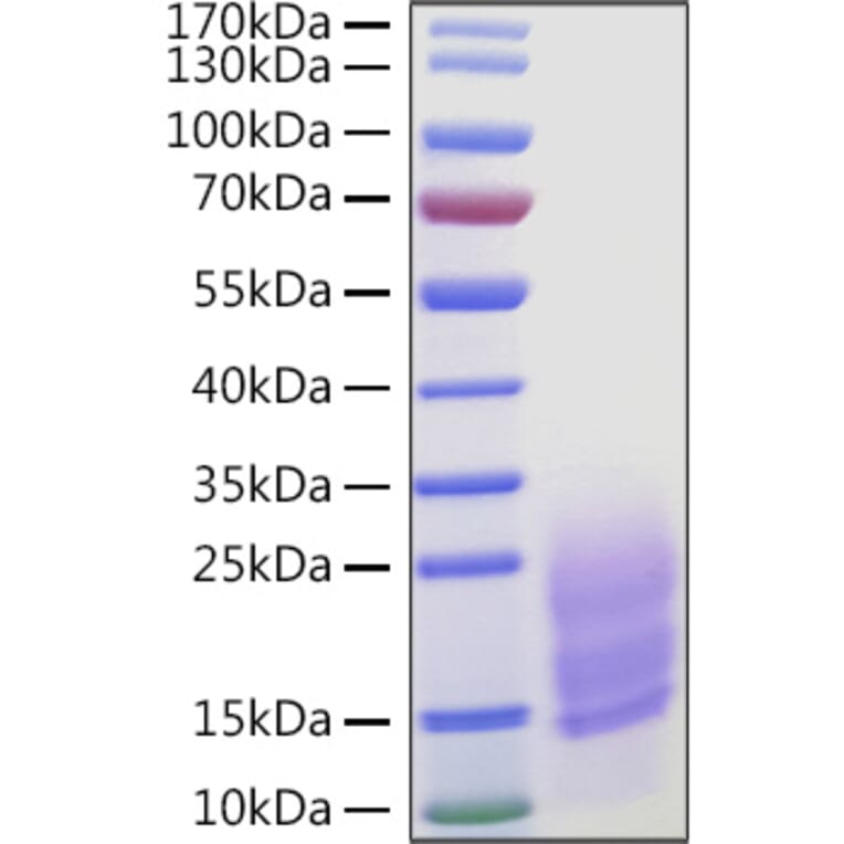 SDS-PAGE - Recombinant Human Fibronectin Protein (C-terminal His Tag) (A330658) - Antibodies.com