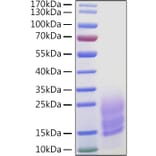 SDS-PAGE - Recombinant Human Fibronectin Protein (C-terminal His Tag) (A330658) - Antibodies.com
