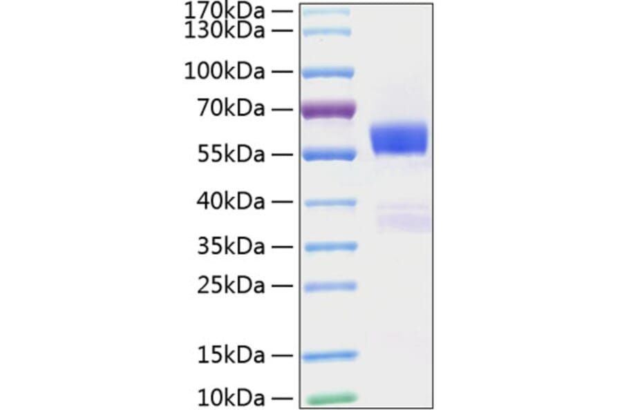 SDS-PAGE - Recombinant Mouse Flt3 ligand/Flt3L Protein (C-terminal Human Fc and His Tag) (A330660) - Antibodies.com