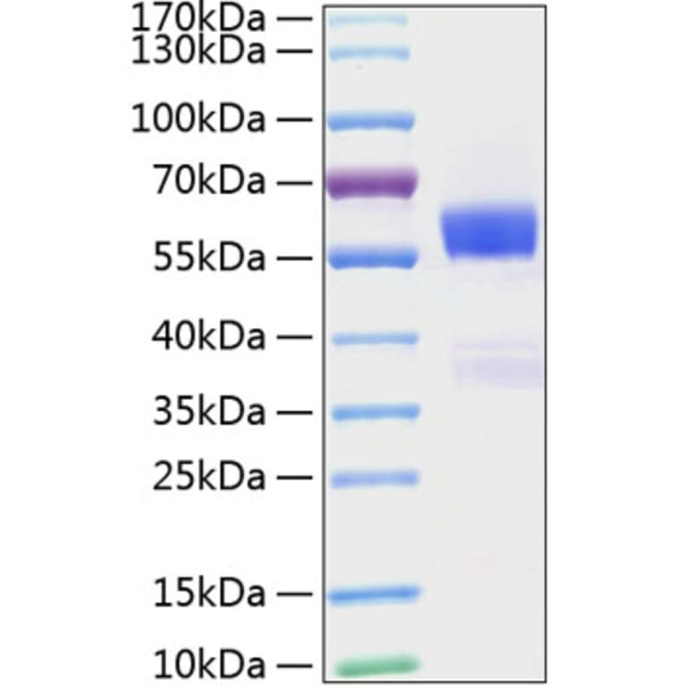 SDS-PAGE - Recombinant Mouse Flt3 ligand/Flt3L Protein (C-terminal Human Fc and His Tag) (A330660) - Antibodies.com