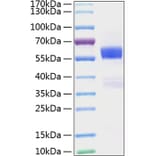 SDS-PAGE - Recombinant Mouse Flt3 ligand/Flt3L Protein (C-terminal Human Fc and His Tag) (A330660) - Antibodies.com