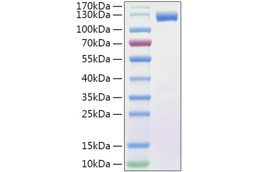 SDS-PAGE - Recombinant Human Flt3/CD135 Protein (C-terminal Human Fc and His Tag) (A330661) - Antibodies.com