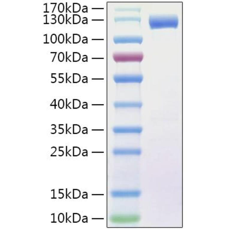 SDS-PAGE - Recombinant Human Flt3/CD135 Protein (C-terminal Human Fc and His Tag) (A330661) - Antibodies.com