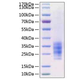 SDS-PAGE - Recombinant Human FLT3L Protein (C-terminal His Tag) (A330663) - Antibodies.com