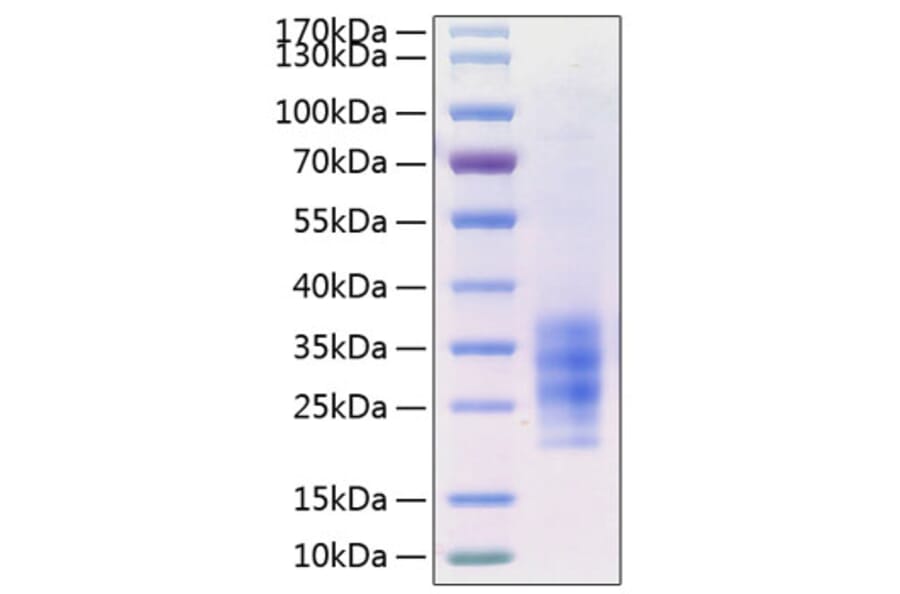 SDS-PAGE - Recombinant Human FLT3L Protein (C-terminal His Tag) (A330663) - Antibodies.com