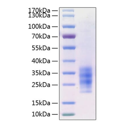 SDS-PAGE - Recombinant Human FLT3L Protein (C-terminal His Tag) (A330663) - Antibodies.com