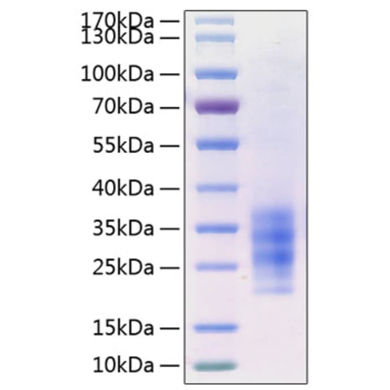 SDS-PAGE - Recombinant Human FLT3L Protein (C-terminal His Tag) (A330663) - Antibodies.com