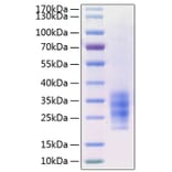 SDS-PAGE - Recombinant Human FLT3L Protein (C-terminal His Tag) (A330663) - Antibodies.com