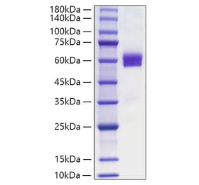 SDS-PAGE - Recombinant Human FLT3L Protein (C-terminal Human Fc Tag) (A330664) - Antibodies.com