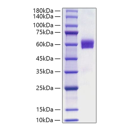 SDS-PAGE - Recombinant Human FLT3L Protein (C-terminal Human Fc Tag) (A330664) - Antibodies.com