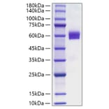 SDS-PAGE - Recombinant Human FLT3L Protein (C-terminal Human Fc Tag) (A330664) - Antibodies.com