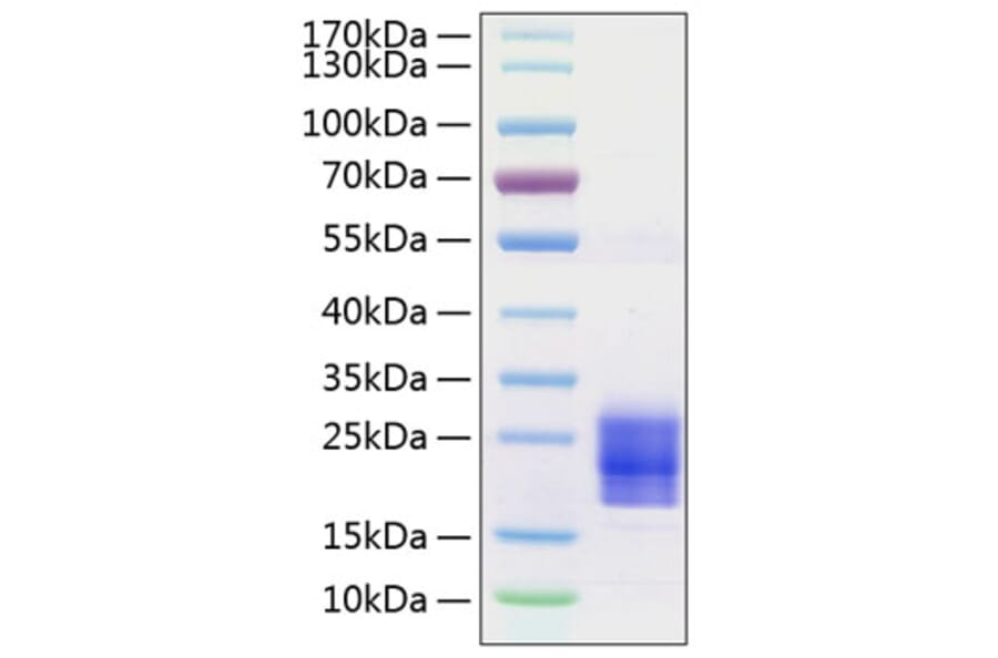 SDS-PAGE - Recombinant Human/Mouse/Rat FNDC5 Protein (C-terminal His Tag) (A330665) - Antibodies.com