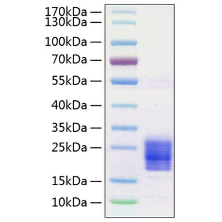 SDS-PAGE - Recombinant Human/Mouse/Rat FNDC5 Protein (C-terminal His Tag) (A330665) - Antibodies.com