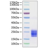 SDS-PAGE - Recombinant Human/Mouse/Rat FNDC5 Protein (C-terminal His Tag) (A330665) - Antibodies.com