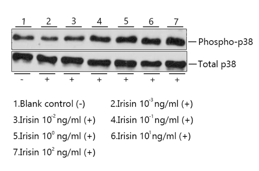 Western Blot - Recombinant Human/Mouse/Rat FNDC5 Protein (C-terminal His Tag) (A330665) - Antibodies.com