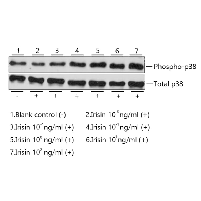 Western Blot - Recombinant Human/Mouse/Rat FNDC5 Protein (C-terminal His Tag) (A330665) - Antibodies.com