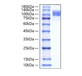 SDS-PAGE - Recombinant Human Follistatin Protein (N-terminal Human Fc Tag) (A330666) - Antibodies.com