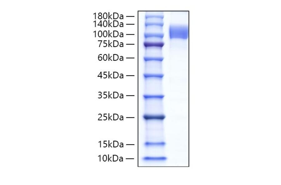 SDS-PAGE - Recombinant Human Follistatin Protein (N-terminal Human Fc Tag) (A330666) - Antibodies.com