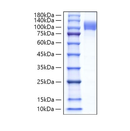 SDS-PAGE - Recombinant Human Follistatin Protein (N-terminal Human Fc Tag) (A330666) - Antibodies.com