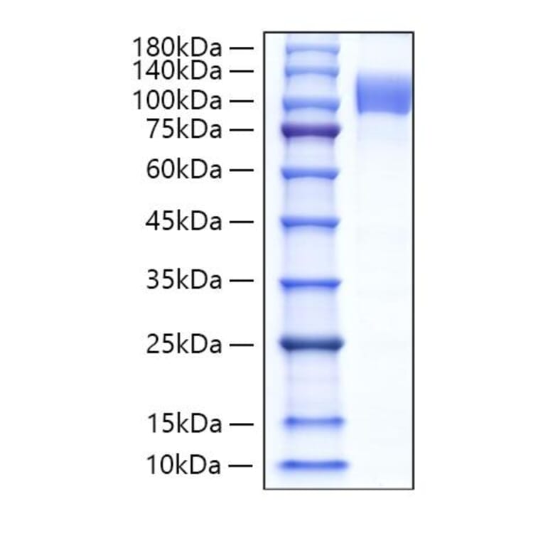 SDS-PAGE - Recombinant Human Follistatin Protein (N-terminal Human Fc Tag) (A330666) - Antibodies.com