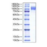SDS-PAGE - Recombinant Human Follistatin Protein (N-terminal Human Fc Tag) (A330666) - Antibodies.com