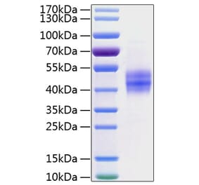 SDS-PAGE - Recombinant Human Follistatin Protein (C-terminal His Tag) (A330667) - Antibodies.com