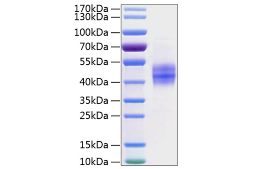 SDS-PAGE - Recombinant Human Follistatin Protein (C-terminal His Tag) (A330667) - Antibodies.com