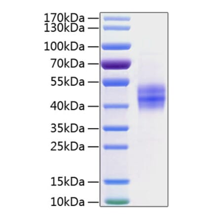 SDS-PAGE - Recombinant Human Follistatin Protein (C-terminal His Tag) (A330667) - Antibodies.com