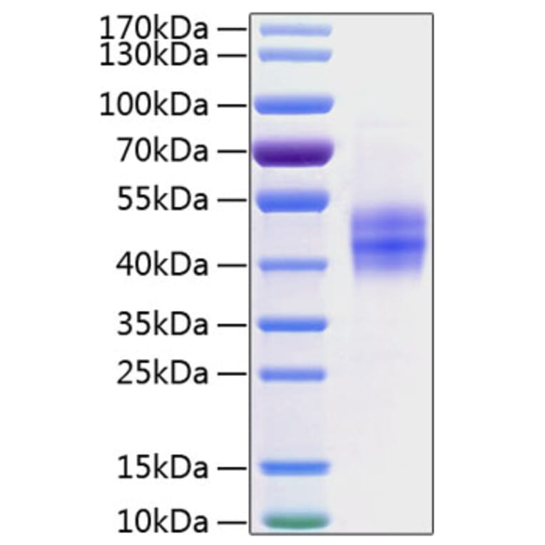 SDS-PAGE - Recombinant Human Follistatin Protein (C-terminal His Tag) (A330667) - Antibodies.com